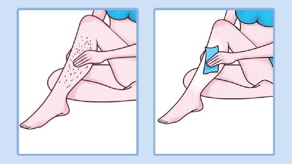 永久激光脱毛多少钱