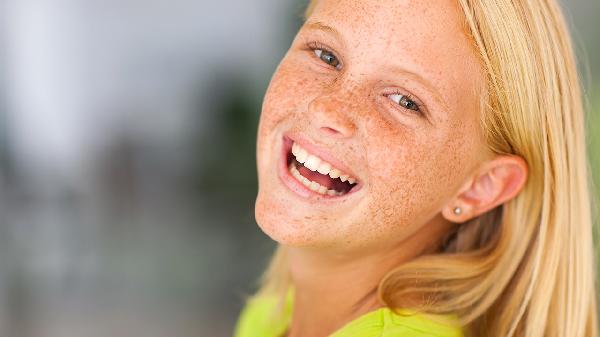 雀斑怎么去除或淡化斑点