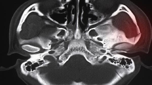 透骨草的功效與作用及禁忌