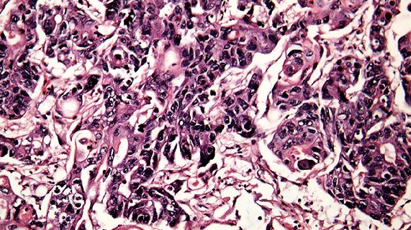 病毒感冒驗血的指標