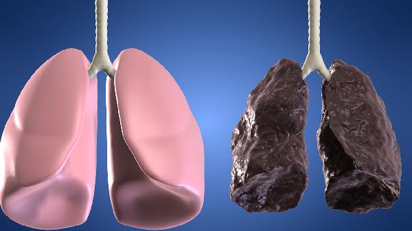 肺部為什么會有積液