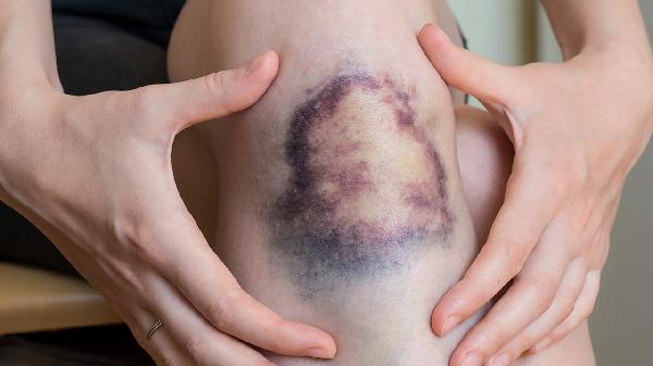 肛門(mén)傷口愈合的藥膏