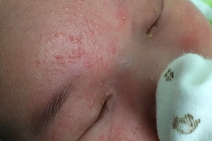 11个月的宝宝半夜咳嗽呕吐如何治疗