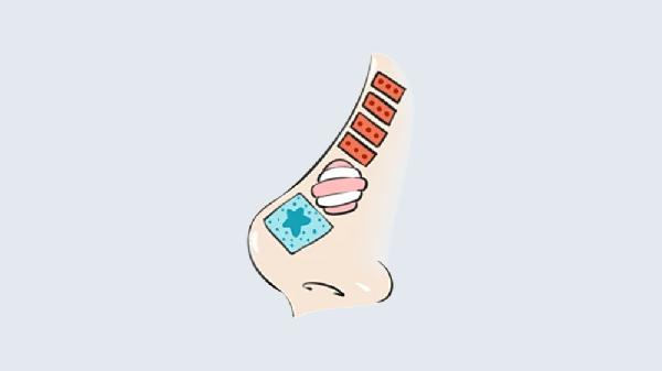 做假體墊鼻基底價錢多少