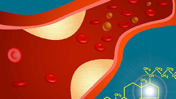 尿紅細(xì)胞兩個(gè)加號(hào)嚴(yán)重嗎