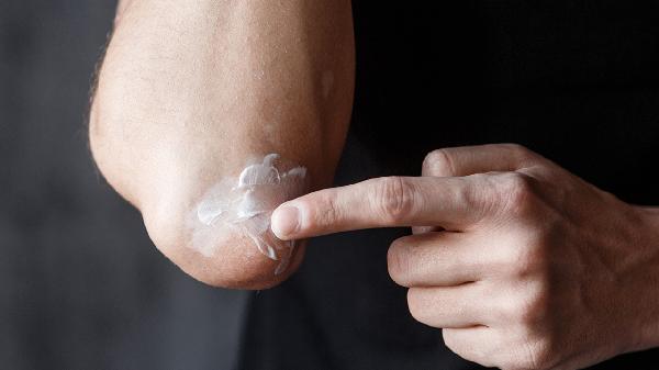 白癜風(fēng)早期的護理方法有哪些